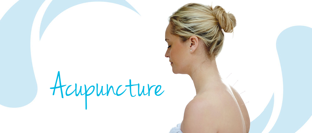 Acupuncture